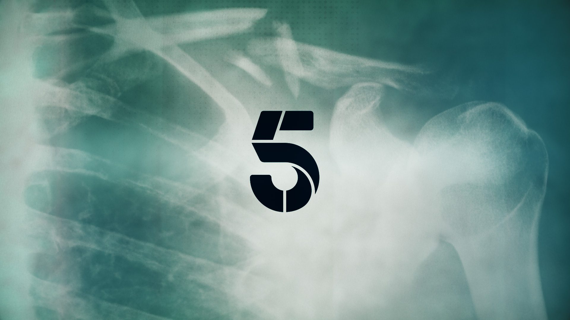 channel 5 logo motion graphics